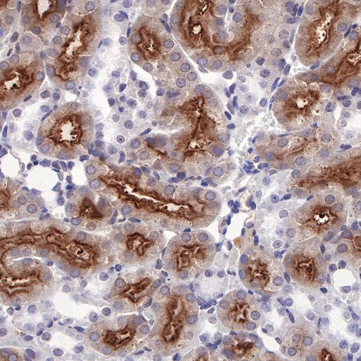Human folate receptor alpha Recombinant Rabbit mAb (SDT-719-20-2)