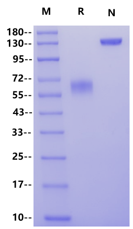 IL-2R alpha/CD25 Fc Chimera Protein, Human