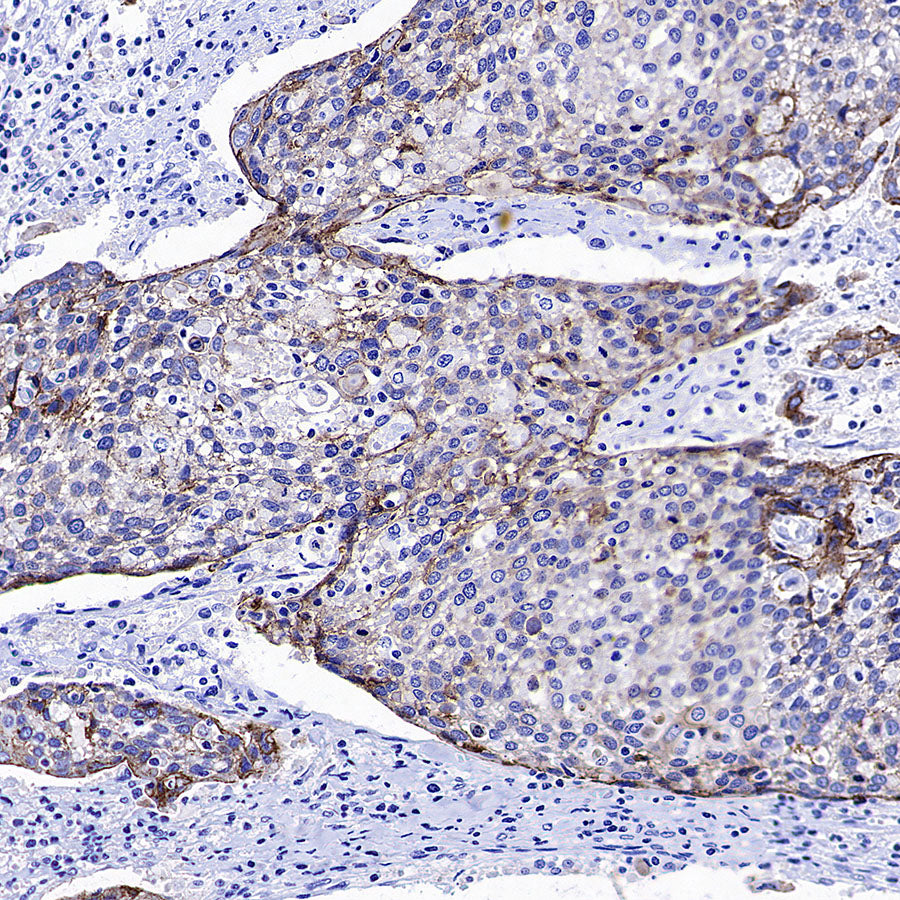 CDH3 Recombinant Rabbit mAb (S-3576-116)