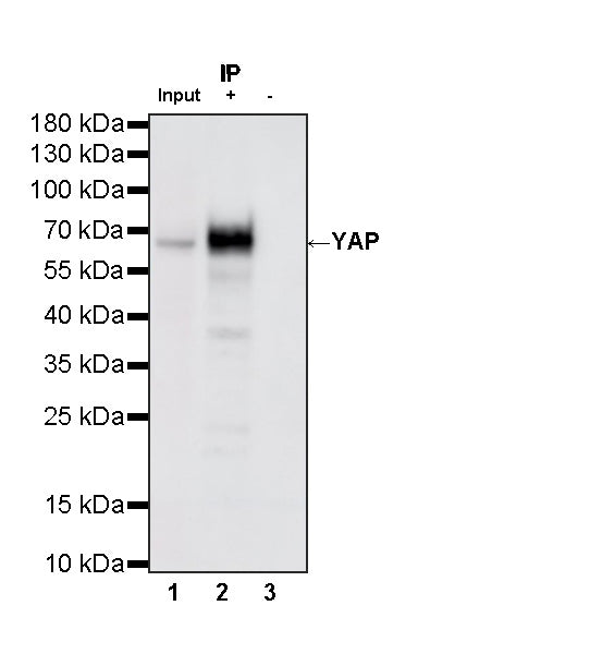 YAP Recombinant Rabbit mAb (S-3921-42)