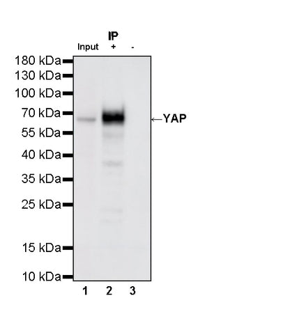 YAP Recombinant Rabbit mAb (S-3921-42)