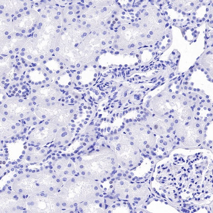MUC17 Recombinant Rabbit mAb (SDT-1415-49)