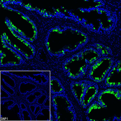 MSMB Recombinant Rabbit mAb (S-3400-1)