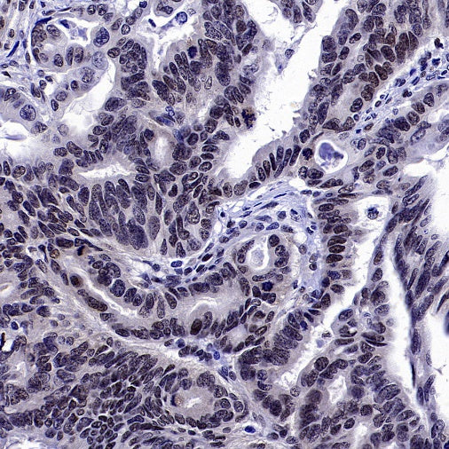SREBP2 Recombinant Rabbit mAb (S-2701-1)