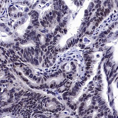 SREBP2 Recombinant Rabbit mAb (S-2701-1)