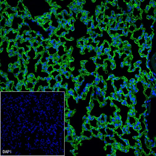 Aquaporin 5/AQP5 Recombinant Rabbit mAb (S-1610-43)