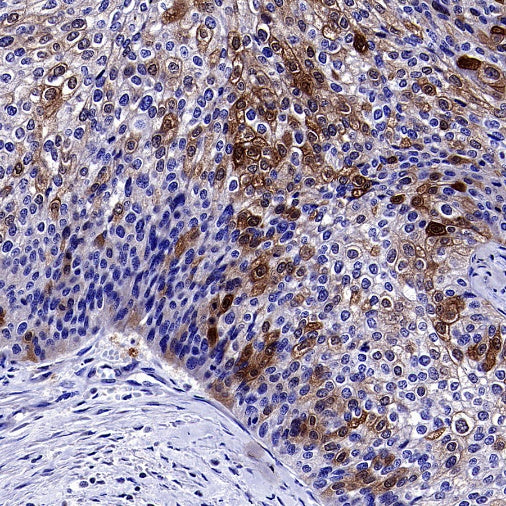 Optineurin Recombinant Rabbit mAb (S-2030-40)