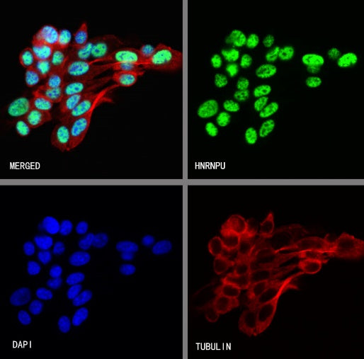 hnRNP U Recombinant Rabbit mAb (S-2375-23)