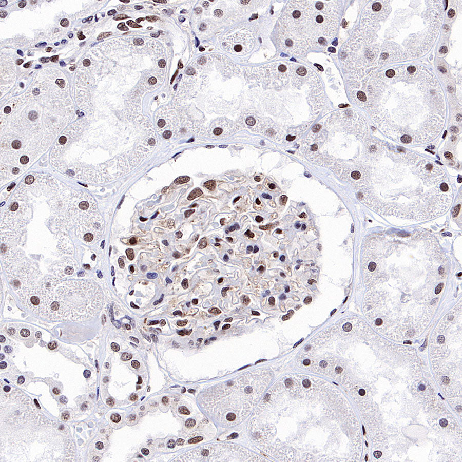 RFX5 Recombinant Rabbit mAb (S-3628-50)