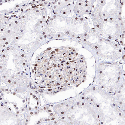 RFX5 Recombinant Rabbit mAb (S-3628-50)