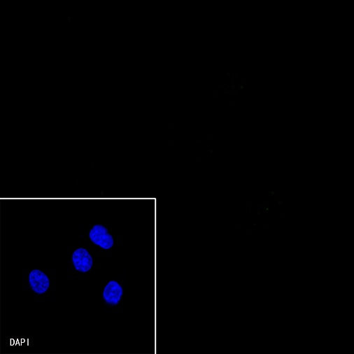 S-RMab® E-Cadherin Recombinant Rabbit mAb (SDT-438-5)