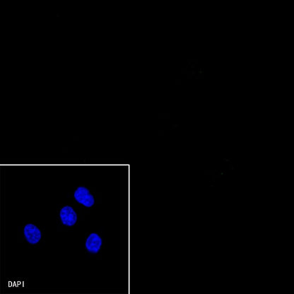 S-RMab® E-Cadherin Recombinant Rabbit mAb (SDT-438-5)