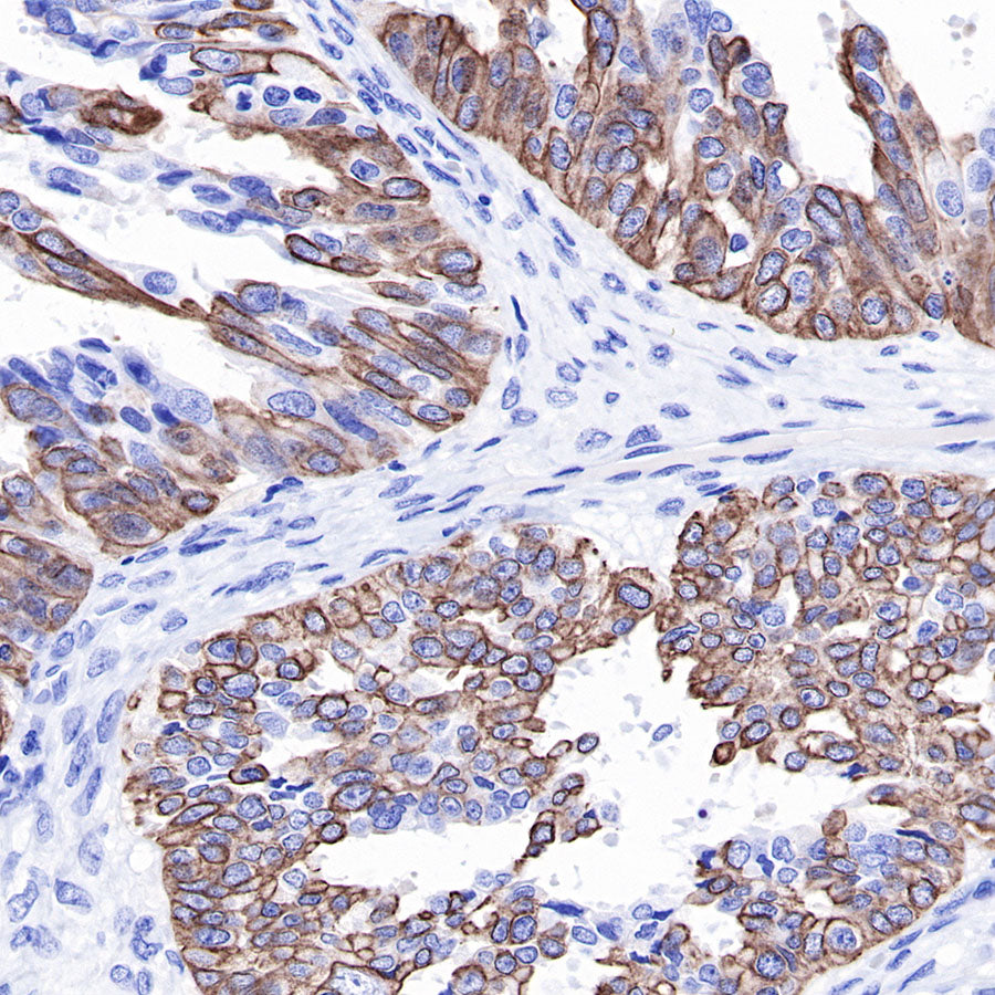 S-RMab® Keratin 18 Recombinant Rabbit mAb (SDT-012-7)