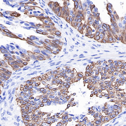 S-RMab® Keratin 18 Recombinant Rabbit mAb (SDT-012-7)