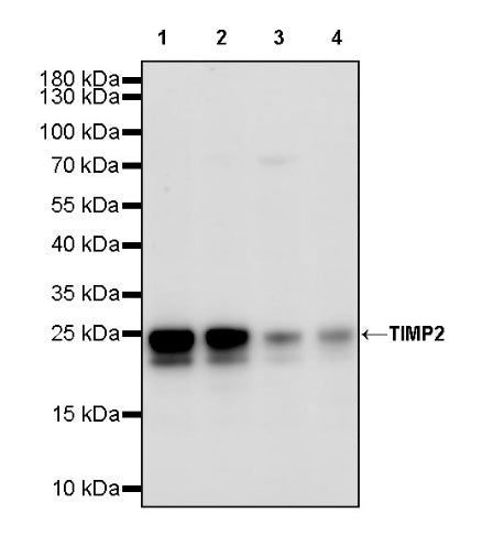 TIMP2 Recombinant Rabbit mAb (S-3369-4)