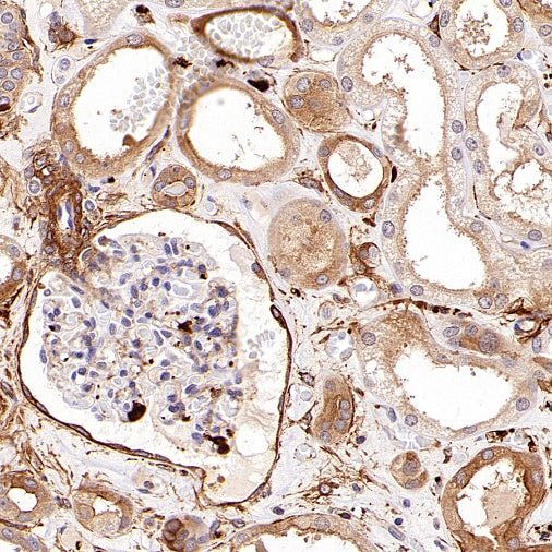 KIF18A Recombinant Rabbit mAb (S-3310-11)