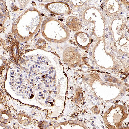 KIF18A Recombinant Rabbit mAb (S-3310-11)