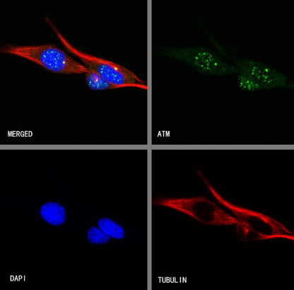 ATM Recombinant Rabbit mAb (S-2178-4)