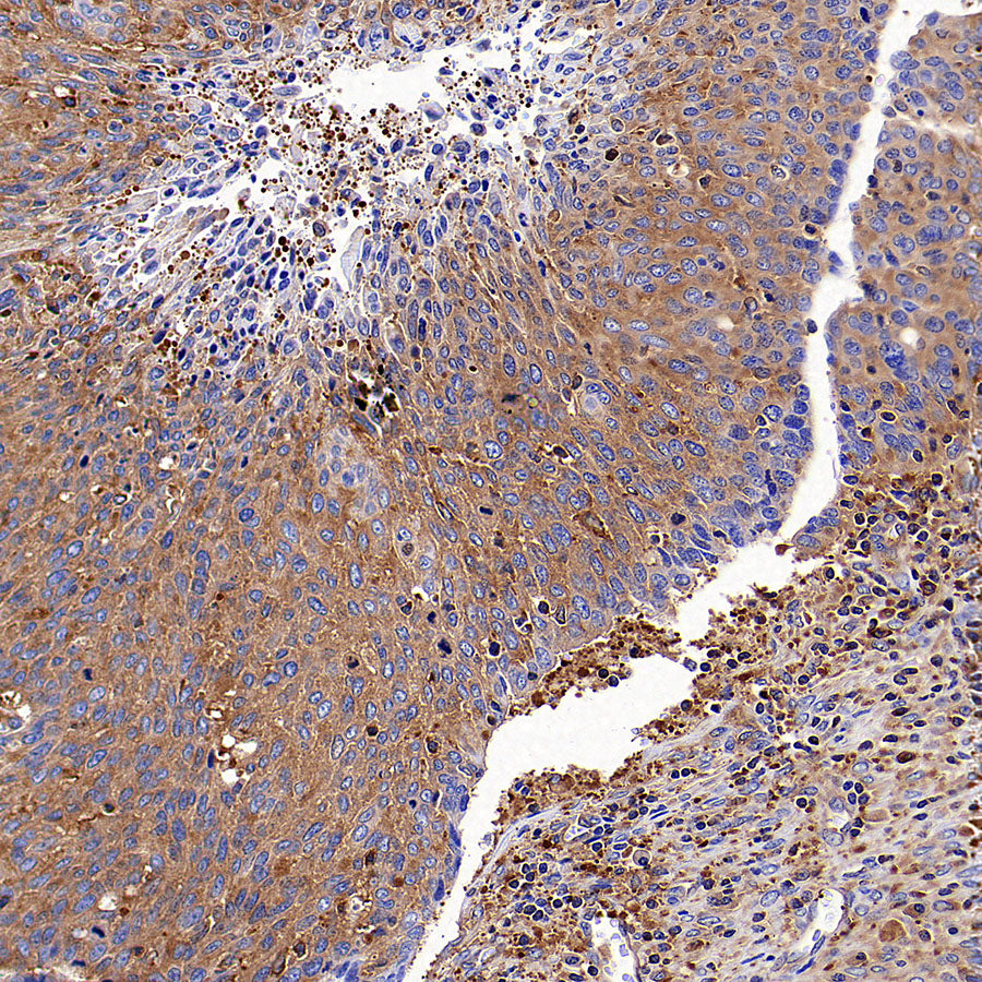 CAP1 Rabbit Polyclonal Antibody