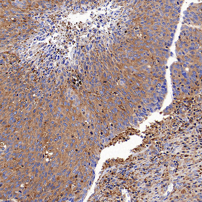CAP1 Rabbit Polyclonal Antibody