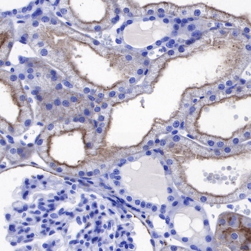 CD90 Recombinant Rabbit mAb (SDT-349-164)