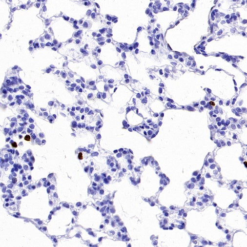 Olfm4 Recombinant Rabbit mAb (S-2748-67)