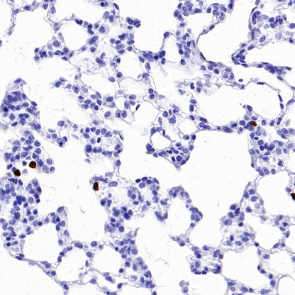 Olfm4 Recombinant Rabbit mAb (S-2748-67)