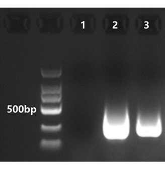 T7 RNA Polymerase