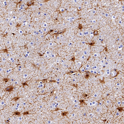 ALDH1L1 Recombinant Rabbit mAb (S-2885-49)