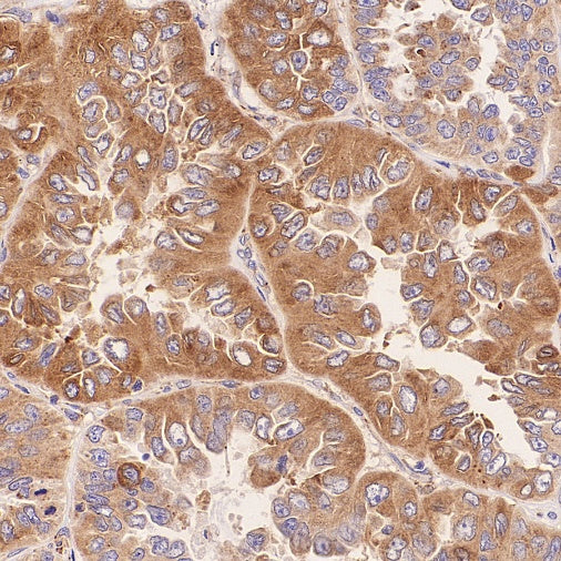 TUBA1B Rabbit Polyclonal Antibody