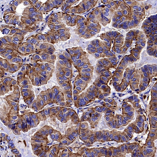 CD107b/LAMP2 Recombinant Mouse mAb (H4B4)