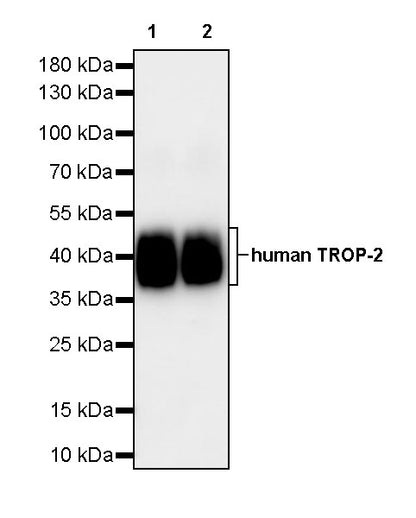 Anti-Human TROP-2 Monoclonal Antibody (Sacituzumab)