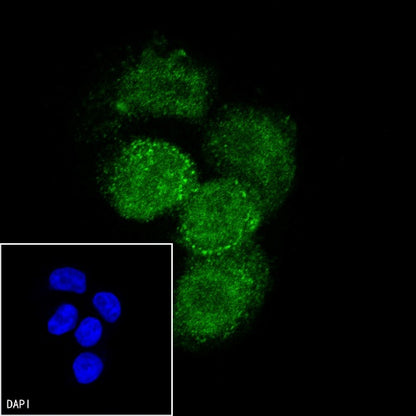 cGAS Recombinant Rabbit mAb (S-708-15)