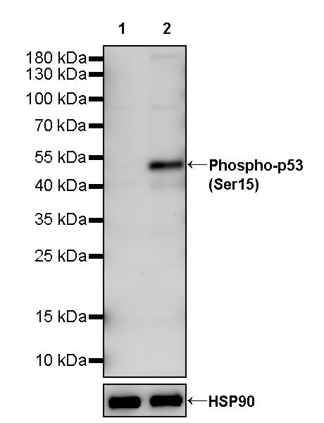 Phospho-p53 (Ser15) Recombinant Rabbit mAb (S-4249)