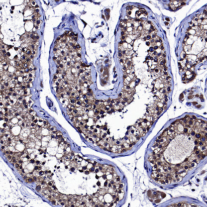 Golgin-245 Recombinant Rabbit mAb (S-4473-8)