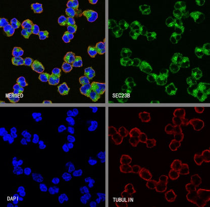 SEC23B Recombinant Rabbit mAb (S-1935-28)
