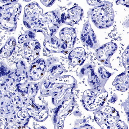 Cyclin E1 Recombinant Rabbit mAb (SDT-4375-29)