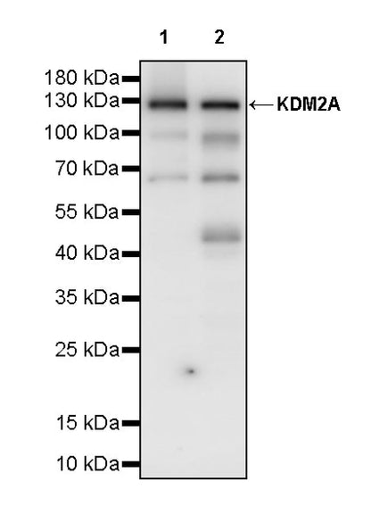 KDM2A Recombinant Rabbit mAb (S-3943-25)