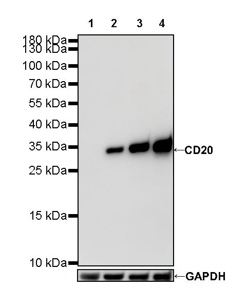 S-RMab® CD20 Recombinant Rabbit mAb,PBS Only (SDT-R133)