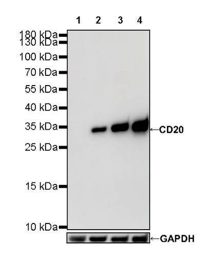 S-RMab® CD20 Recombinant Rabbit mAb,PBS Only (SDT-R133)