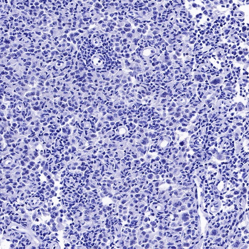 S-RMab® PAX5 Recombinant Rabbit mAb (SDT-R202)