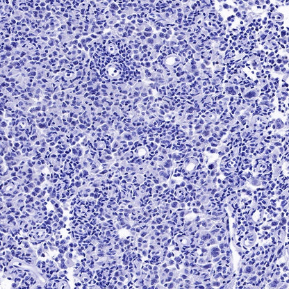 S-RMab® PAX5 Recombinant Rabbit mAb (SDT-R202)
