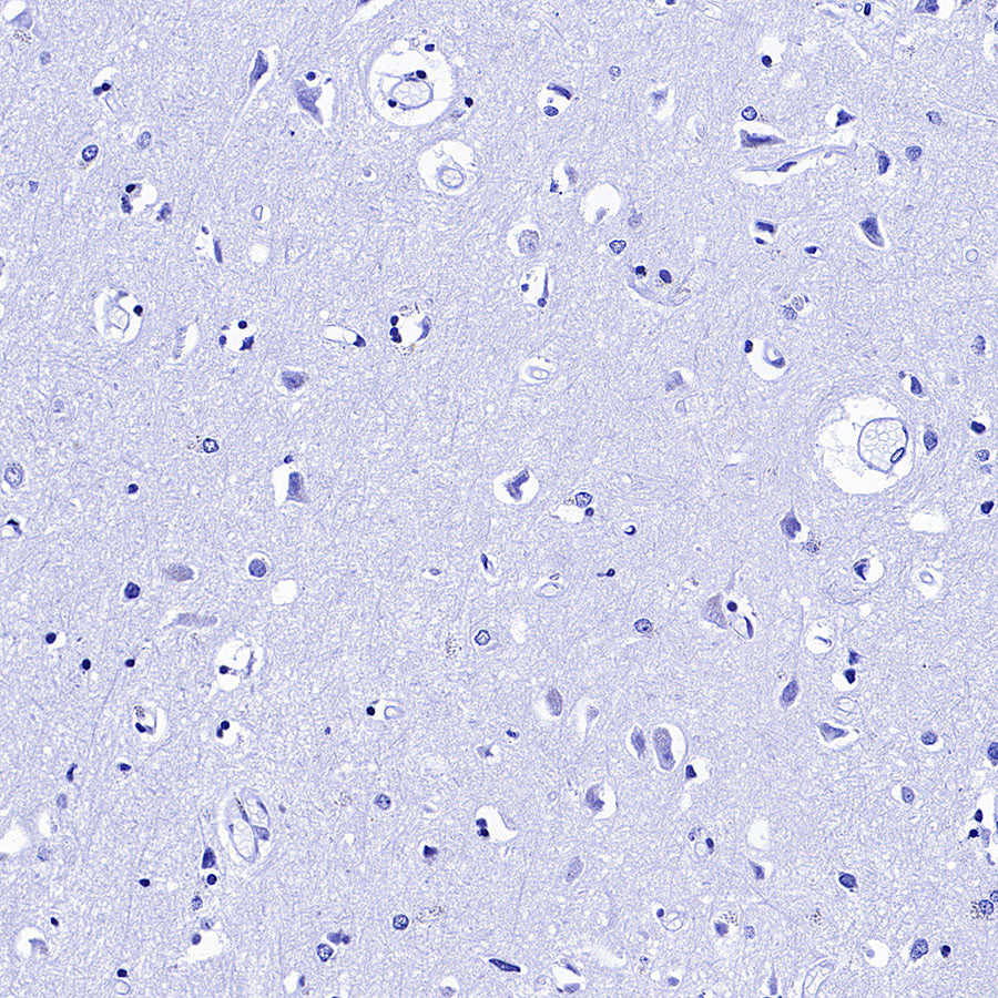 CREM Recombinant Rabbit mAb (S-3375-19)