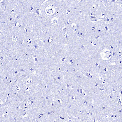 CREM Recombinant Rabbit mAb (S-3375-19)
