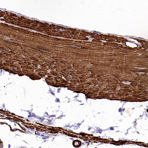 alpha smooth muscle Actin (acetyl E3) + ACTG2 (acetyl E3) Recombiant Rabbit mAb (S-3355)