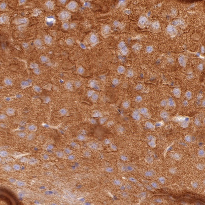 S-RMab® Pan Trk Recombinant Rabbit mAb (SDT-512-5)