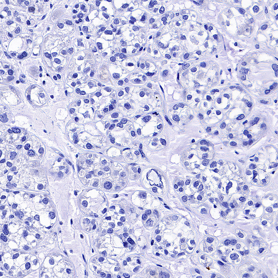 POU2F3 Recombinant Rabbit mAb (S-5525)