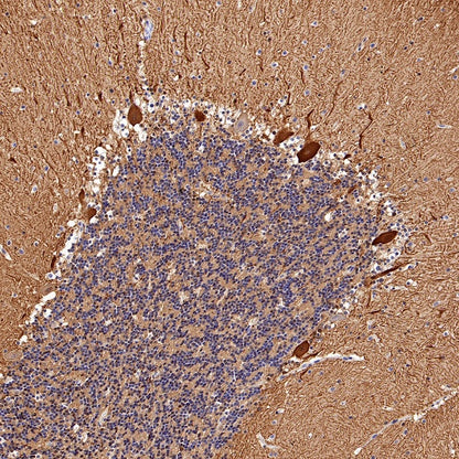 Calbindin Recombinant Rabbit mAb (S-774-378)