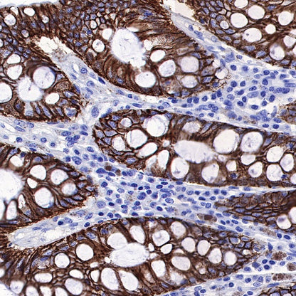 S-RMab® Cadherin 17 Recombinant Rabbit mAb (SDT-736-23)