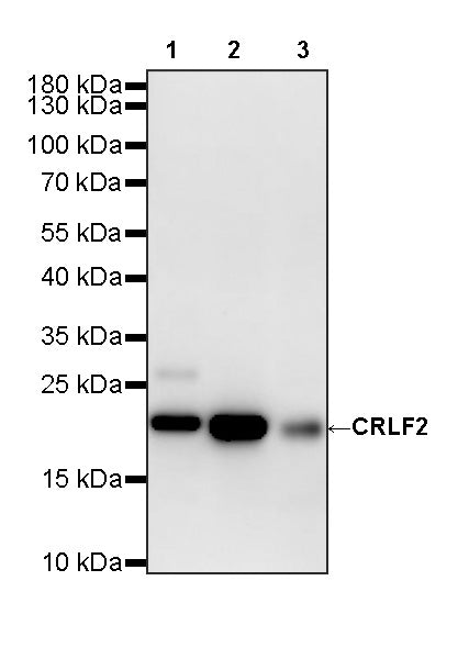 COPZ1 Recombinant Rabbit mAb (S-4445-53)
